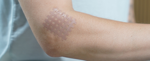 Gittertape online kaufen im Kübler Sport Onlineshop Netzartiges Gittertape zur Therapieunterstützung für verschiedene Körperbereiche anwenden