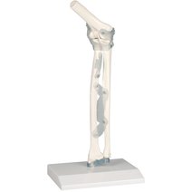 Erler-Zimmer Ellenbogengelenk mit Bänder