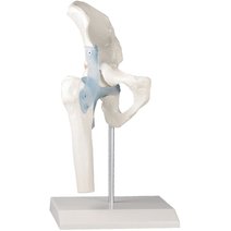 Erler-Zimmer Hüftgelenk mit Bändern