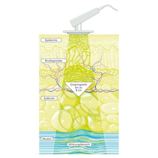 PHYSIOMED® DEEP OSCILLATION® Personal Basic