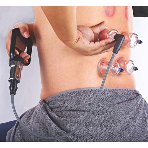 AcuTop® Schröpf Set