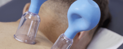 Schr&ouml;pfgl&auml;ser