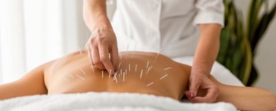 Traditionelle Chinesische Medizin