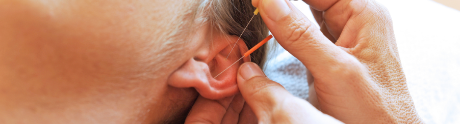 Professionelles Akupunktur Zubehör für Therapien in Praxis und medizinischen Einrichtungen