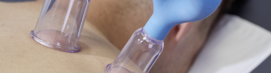 Schröpfgläser aus Glas, Silikon und Kunststoff zur Anwendung in Therapie und Praxis